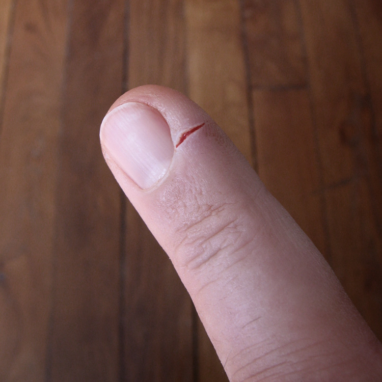 It really hurts !