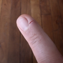 It really hurts !