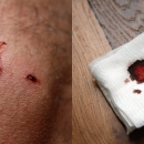 it hurts (really)